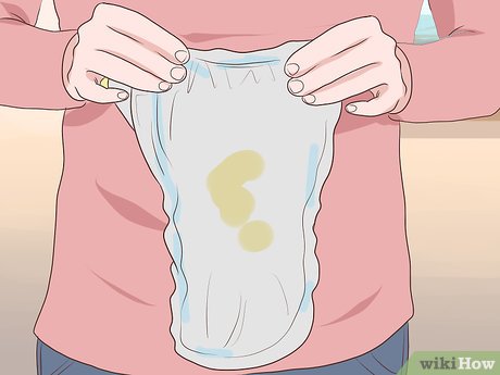 اشكال المناطق الحساسه