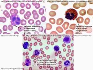 تحليل eosinophils ماهو