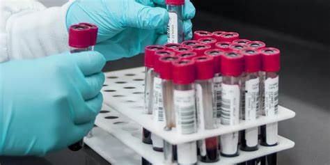 rbc تحليل قراءة تحليل تعداد كريات الدم الحمراء